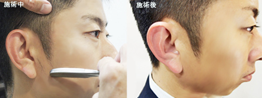 高槻市 | ビーム・ヘアサロン（理容・床屋・散髪）  | 大阪府・大阪市・吹田市・豊中市・箕面市・茨木市・枚方市｜新感覚ビジネスヘア・サイドパート・ベリーショート｜もみあげのシェービング／新感覚ビジネスヘア